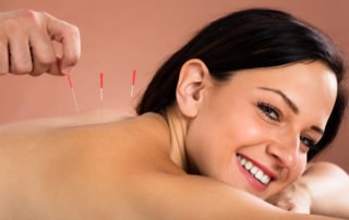 Woman Receiving Acupuncture Treatment from oregon workers compensation benefits