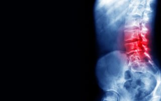 back pain oregon workers compensation attorneys