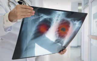 workers-compensation lung conditions